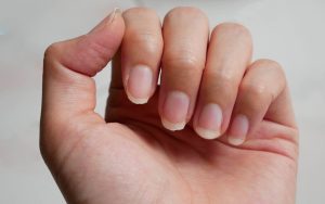 10 Dấu Hiệu Bất Thường Trên Móng Tay Cảnh Báo Vấn Đề Sức Khỏe
