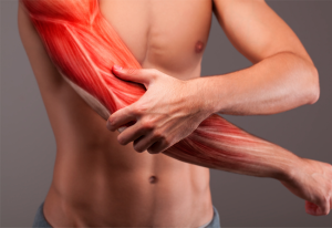 Bệnh Viêm Cơ: Nguyên Nhân, Triệu Chứng, Chẩn Đoán và Điều Trị thumbnail